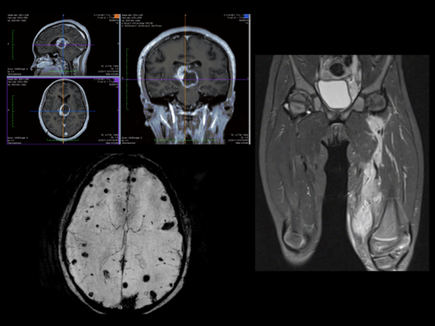 Episode 4: Pediatric MRI course image