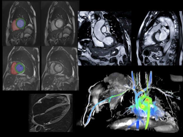 Cardiac MRI course image