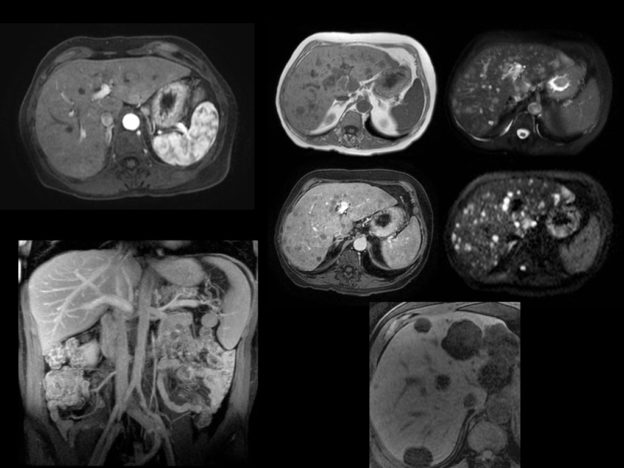 Episode 12: Body MRI course image