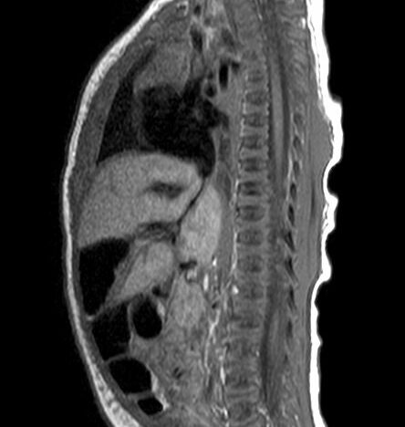 Dosing Strategies and Protocols in Pediatric MRI Part 1 course image