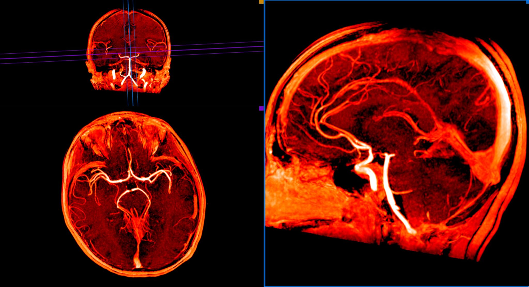 Episode 29 Pediatric MRI Considerations MRiCast