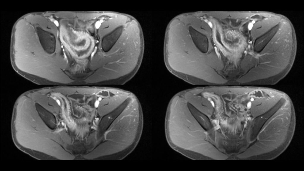 Episode 30: Body MRI
