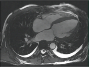 Episode 31: Cardiac MRI Update