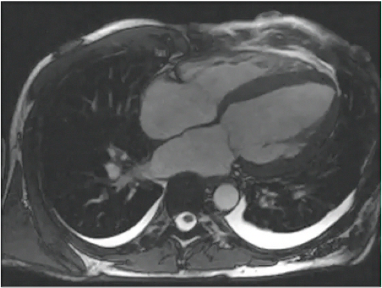 Episode 31 Cardiac MRI course image