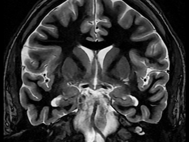 Episode 36 MRI of the Central Nervous System course image